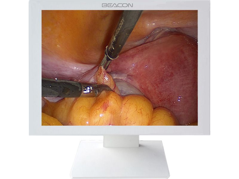 Beacon E150 15" XGA Endoscopy LCD Monitor