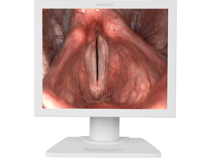 Beacon E190 19" SXGA Endoscopy LCD Monitor