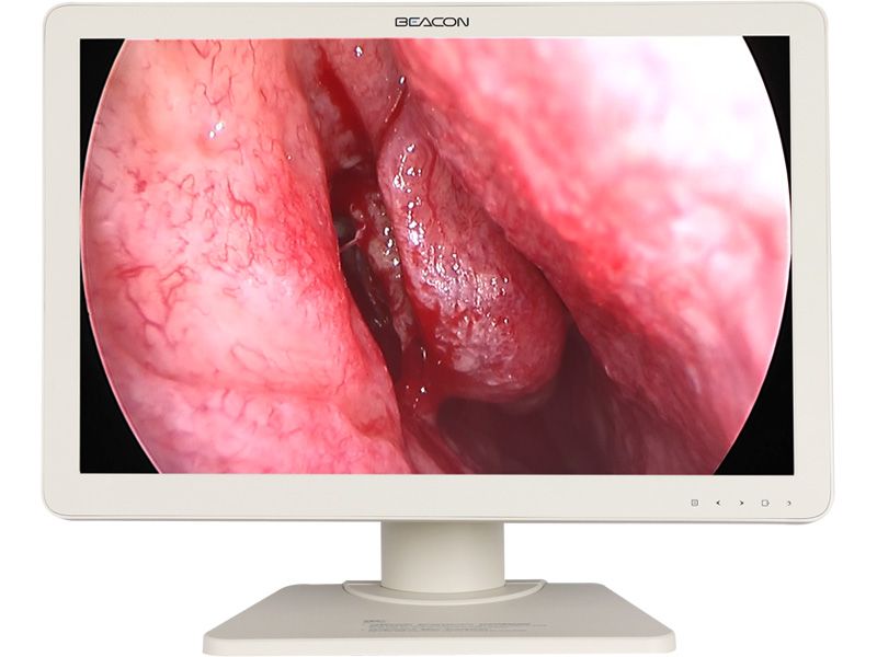 Beacon E2421 24" FHD Endoscopy LCD Monitor