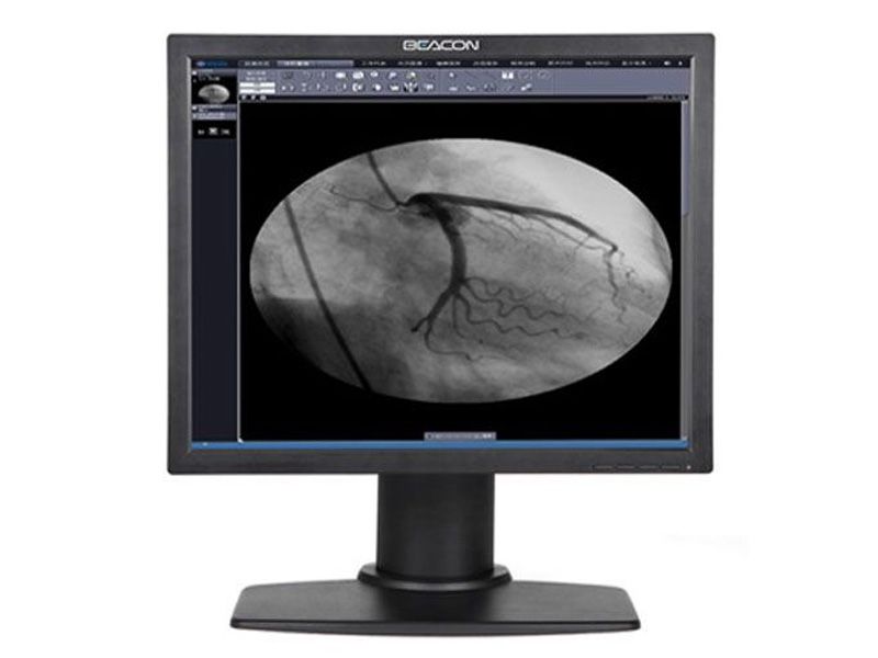 Beacon G11S 1MP Clinical Review Display Monitor