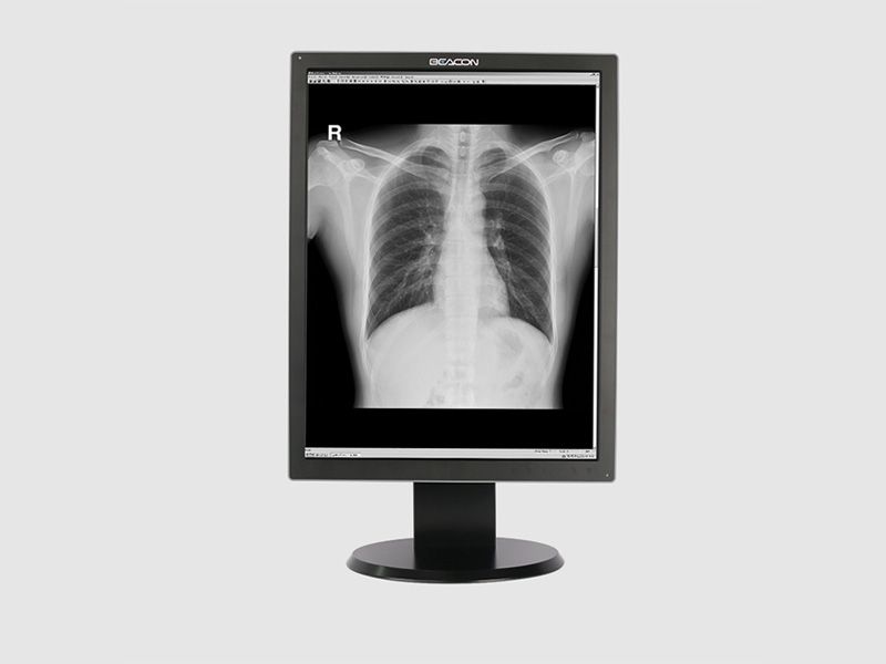 Beacon G23S+ 2MP Diagnostic Radiology Monitor
