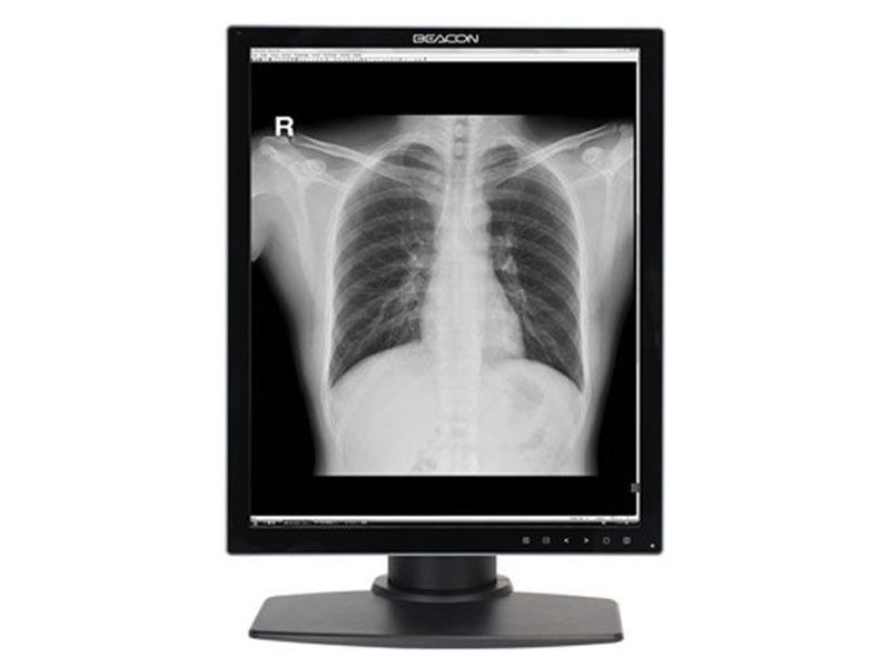 Beacon G32S+ 3MP Diagnostic Radiology Monitor