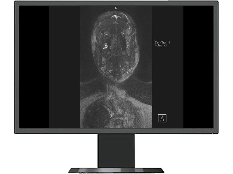 Beacon HL2316SHA 23.8" FHD Clinical Review Touchmonitor