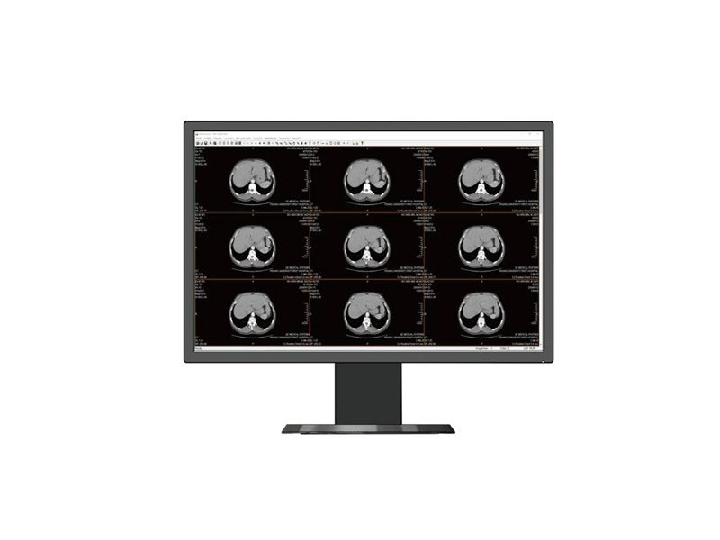 Beacon HL2316SHA 23.8" FHD Clinical Review Touchmonitor