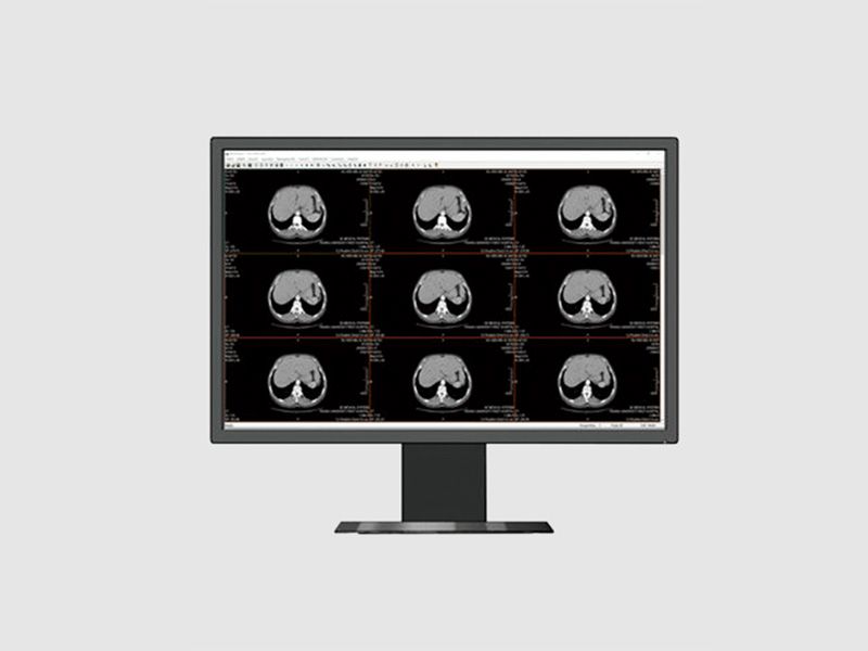 Beacon HL2416SH 24" WUXGA Clinical Review LCD Monitor