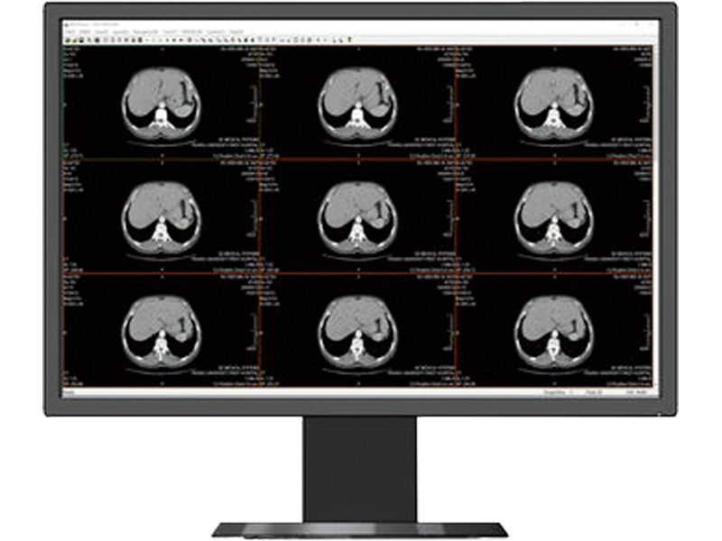 Beacon HL2416SH 24" WUXGA Clinical Review LCD Monitor