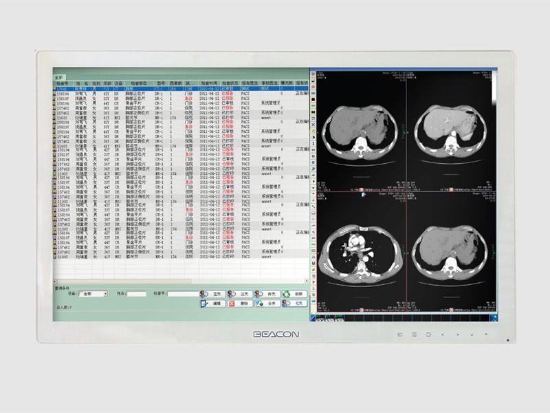 Beacon HL2416SHT 24" WUXGA Clinical Review Touchmonitor