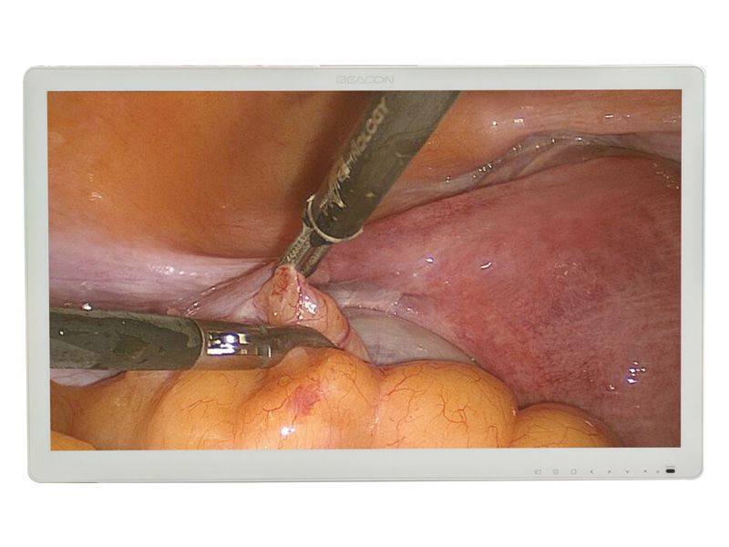 Beacon S271P 27" FHD Surgical LCD Monitor