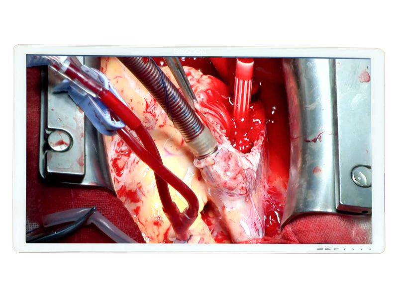 Beacon S3221P 31.5" FHD Surgical LCD Monitor