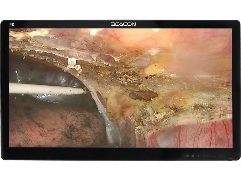 Beacon S3281P 31.5" 4K UHD Surgical LCD Monitor