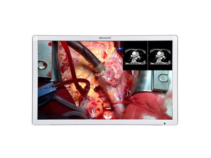 Beacon S421 42" LED Surgical Monitor