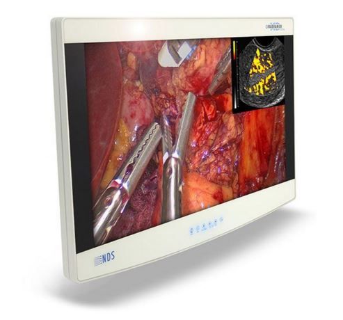 NDSsi Radiance 32" FHD G2 Surgical LCD Monitor 90R0076 w/o Single Fiber
