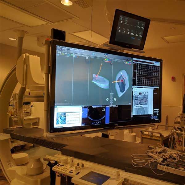 Cath Lab Monitor Shield 60