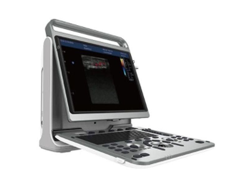 Chison EBit 50 Diagnostic Ultrasound Imaging System