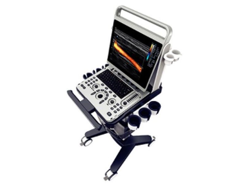 Chison EBit 50 Diagnostic Ultrasound Imaging System
