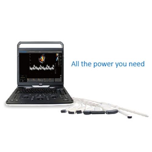 Chison EBit 60 Diagnostic Ultrasound Imaging System