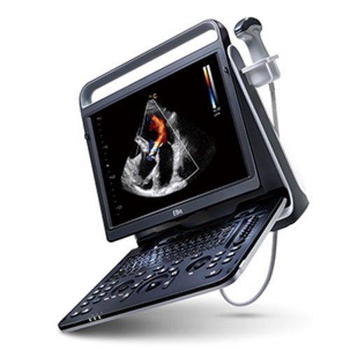Chison EBit 60 Diagnostic Ultrasound Imaging System