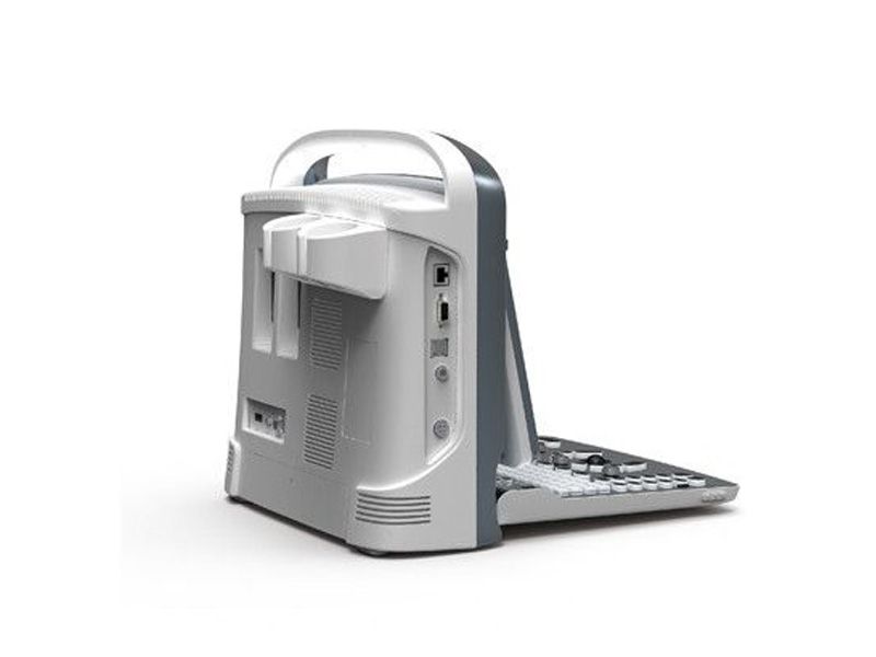 Chison ECO 1 Ultrasound Imaging System