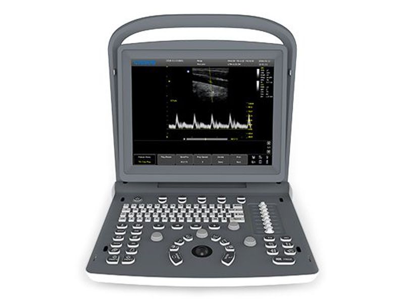 Chison ECO 2 Ultrasound Black and White System