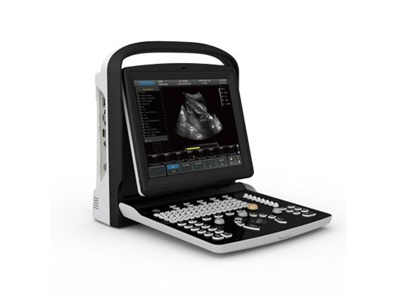 Chison ECO 3 Ultrasound Imaging System