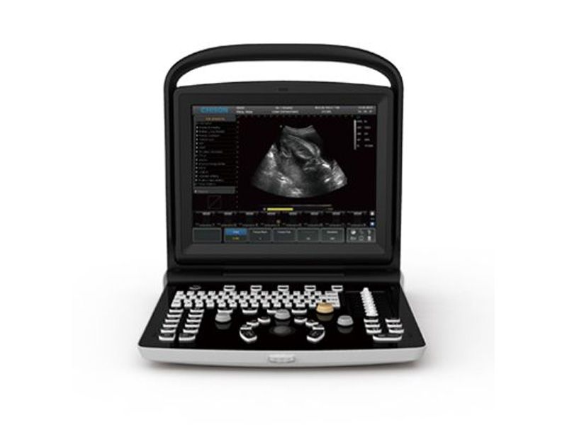 Chison ECO 3 Ultrasound Imaging System