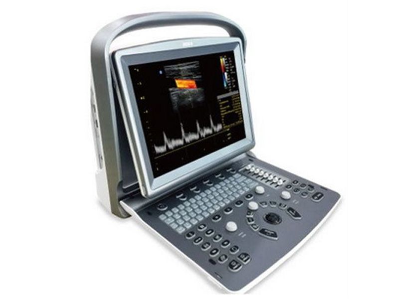 Chison ECO 6 Ultrasound Imaging System