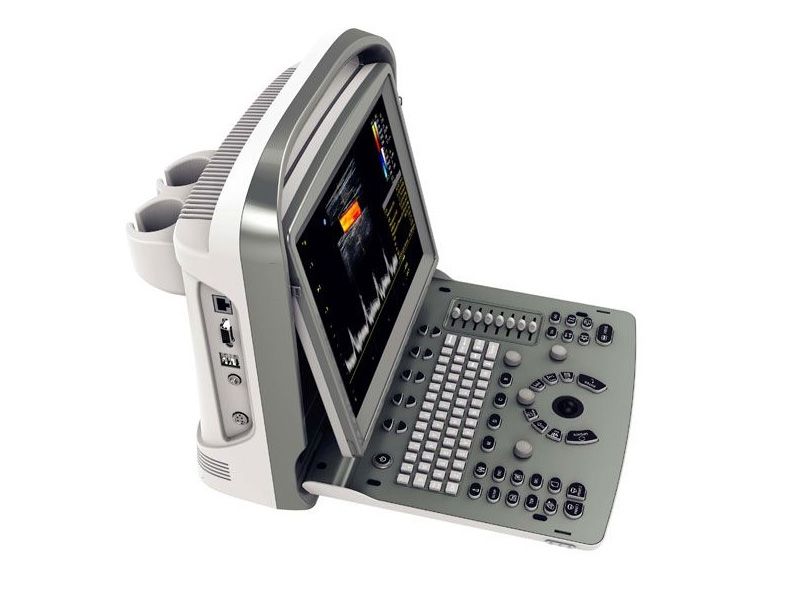 Chison ECO 6 Ultrasound Imaging System