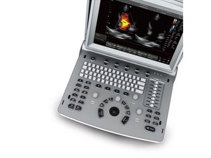 Chison ECO 6 Ultrasound Imaging System