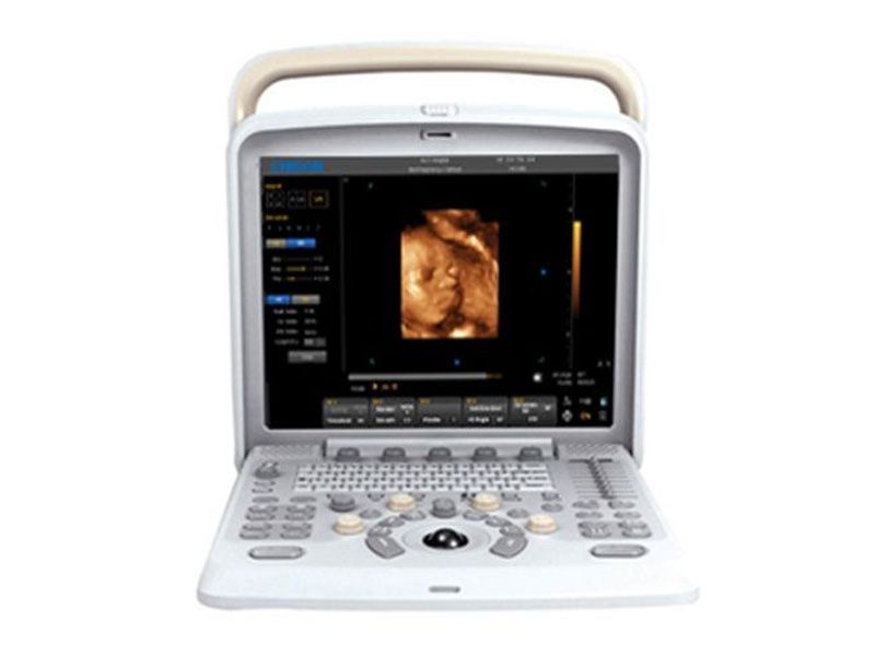 Chison Q5 Ultrasound Imaging System - Refurbished