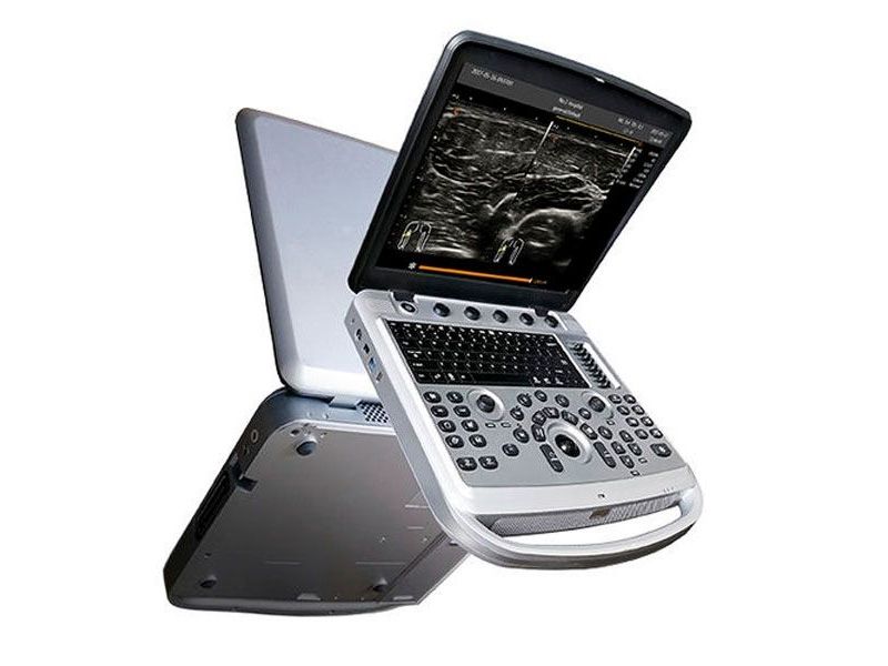 Chison SonoBook 6 Ultrasound Imaging System