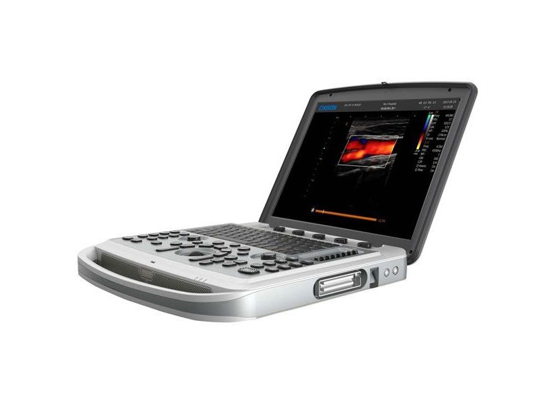 Chison SonoBook 9 Ultrasound Imaging System
