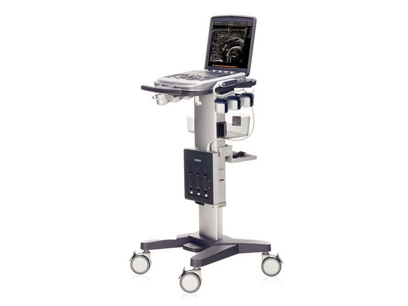 Chison SonoBook 9 Ultrasound Imaging System