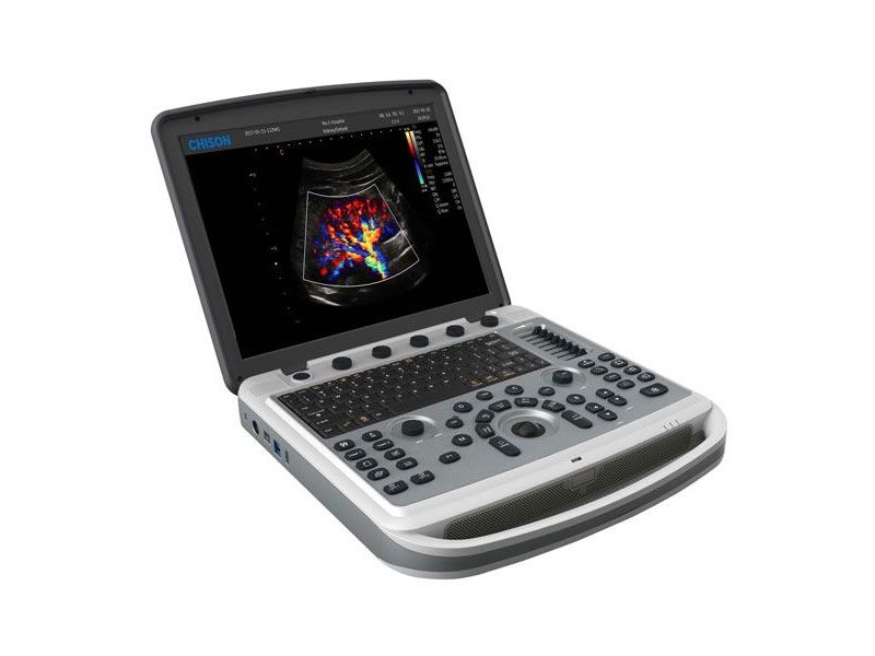 Chison SonoBook 9 Ultrasound Imaging System