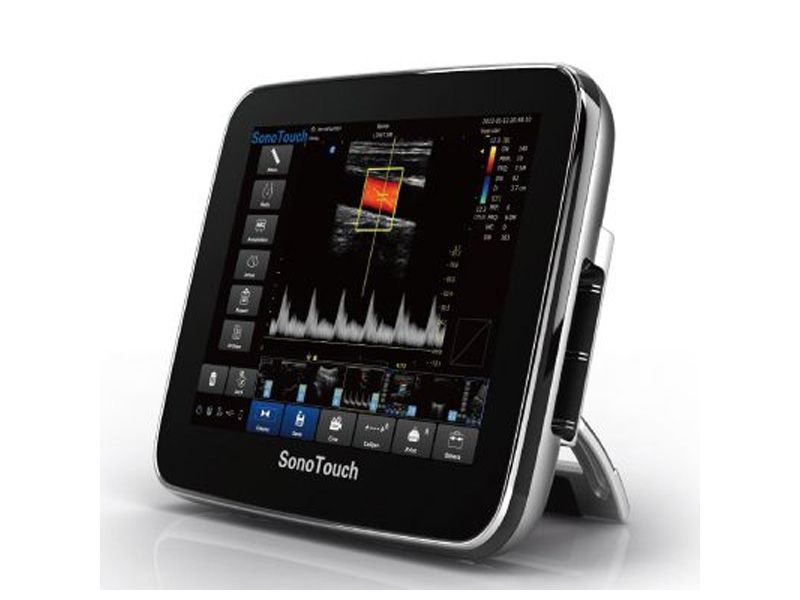 Chison Sonotouch 30 Ultrasound Imaging System