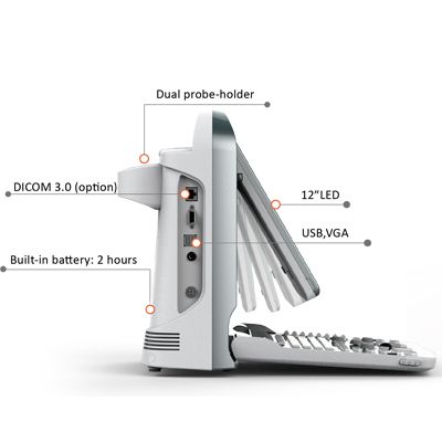 Chison ECO 5 Ultrasound Imaging System