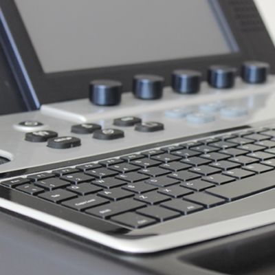 Chison i9 Ultrasound Imaging System