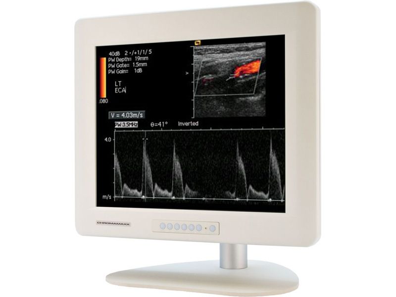 Chromamaxx 17CMIW 17" SXGA LCD Monitor