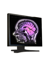 Chromamaxx 18CSY 18-inch Color LCD Monitor
