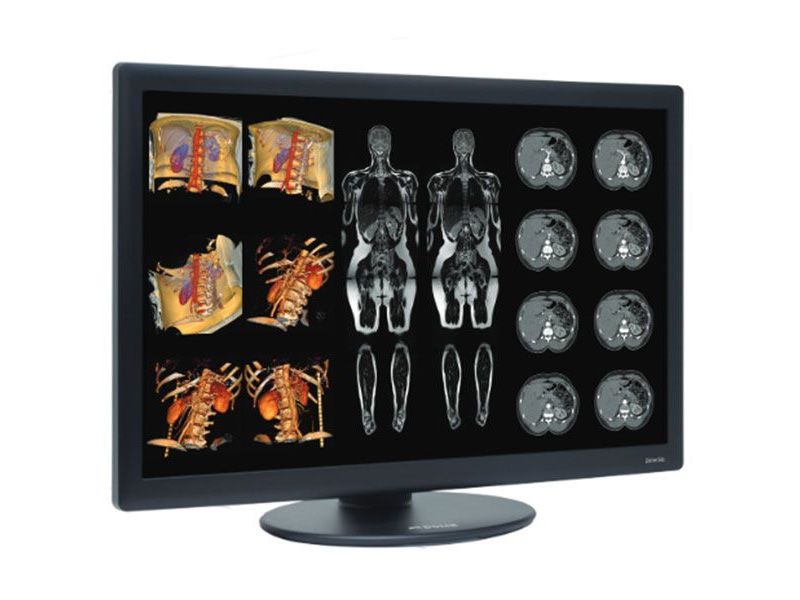 NDSsi Dome S6c 6MP Diagnostic Radiology Monitor