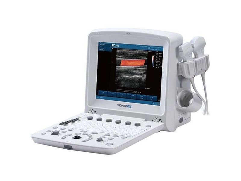 Edan U50 Prime Diagnostic Ultrasound System