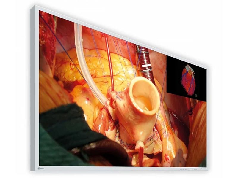 Eizo EX4342 43" 4K UHD Surgical Monitor
