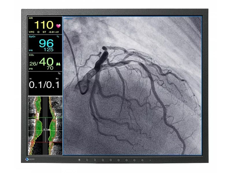 Eizo LX1910-S 19" SXGA Surgical LCD Monitor