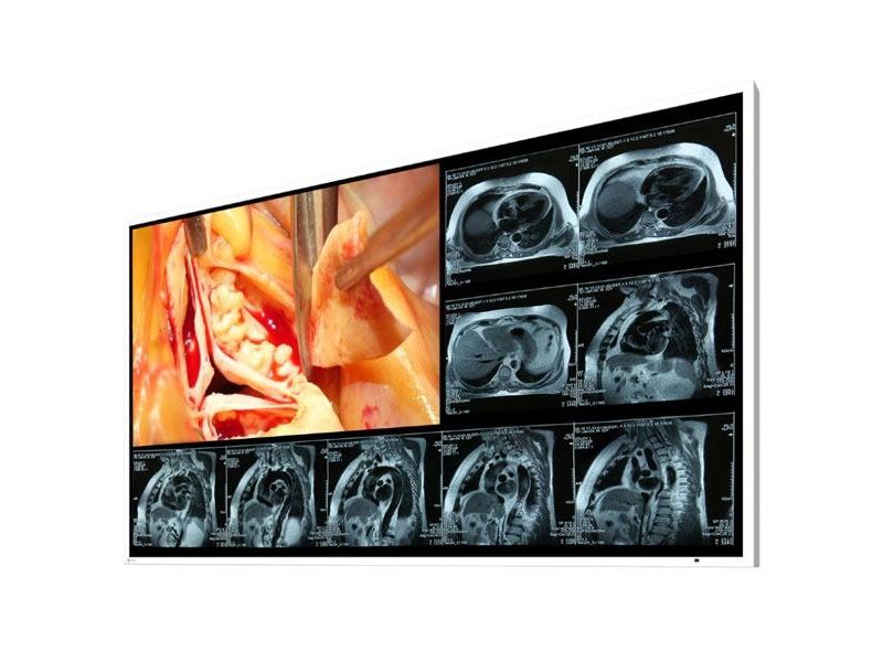 Eizo LX490W 49" FHD Surgical LCD Monitor