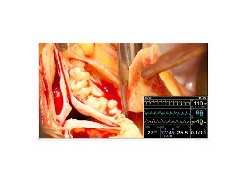 Eizo LX491W 49" FHD Surgical LCD Monitor