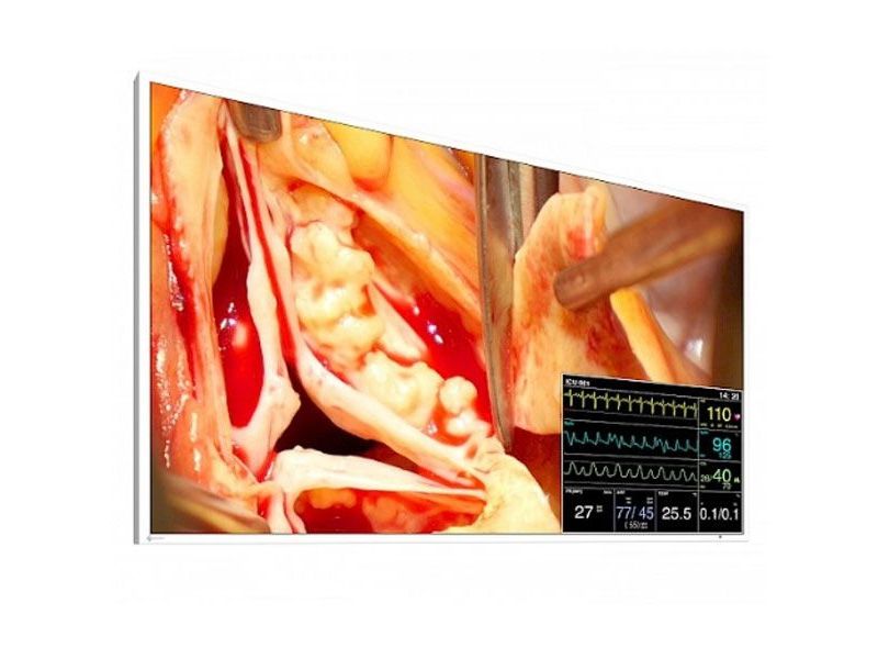 Eizo LX491W 49" FHD Surgical LCD Monitor