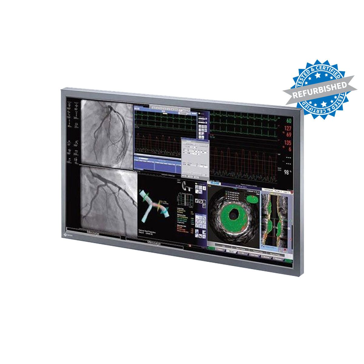 Eizo DSC 5608-DC 56" 4K UHD Large Cath Lab Surgical LCD Monitor