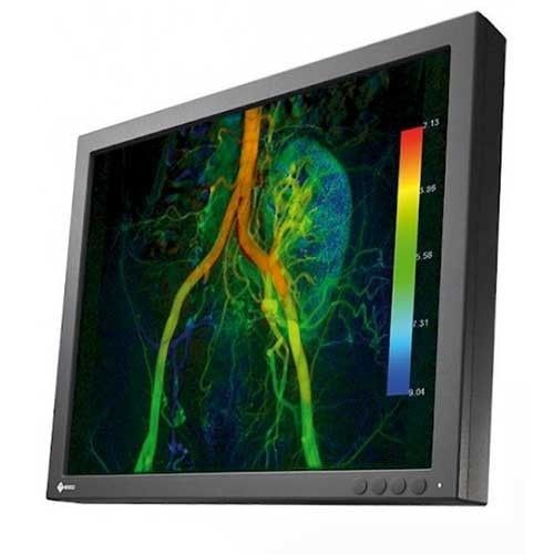 Eizo CuratOR EX190 19" SXGA Surgical LCD Monitor