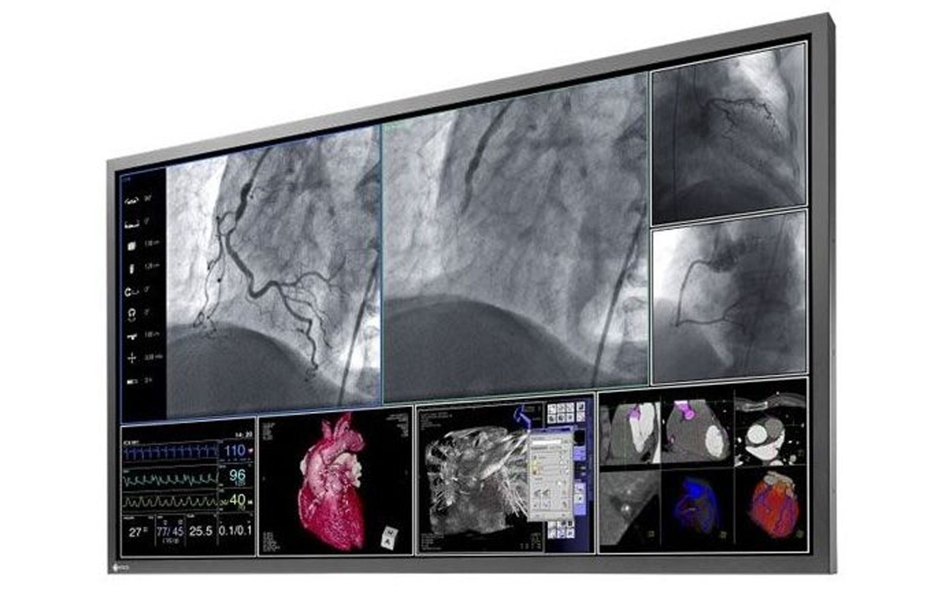 Eizo LS580W 58" 4K UHD Large Cath Lab Surgical Monitor