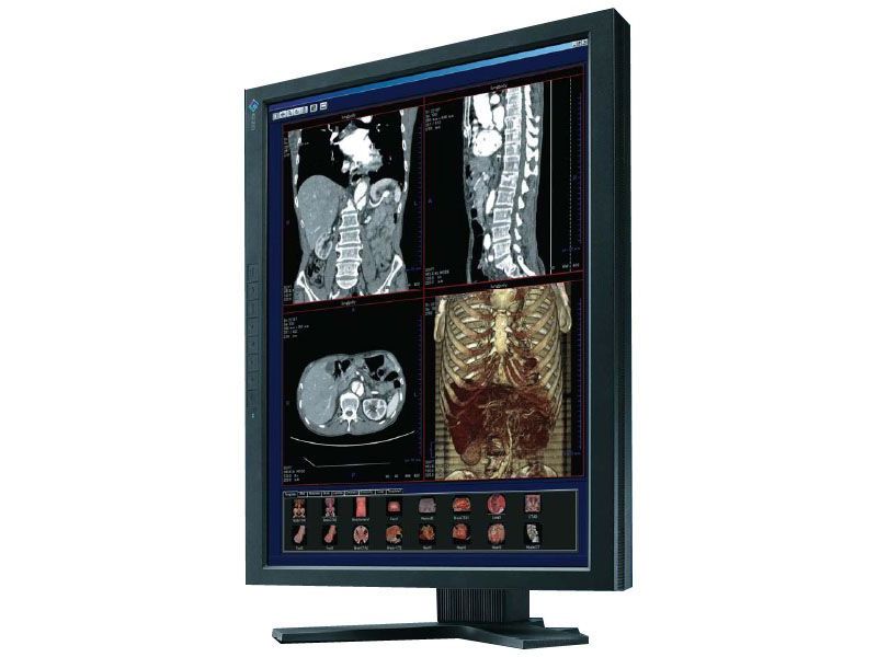 Eizo RadiForce R22 2MP Diagnostic Radiology Monitor