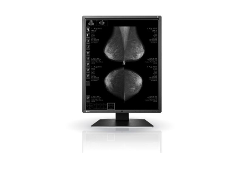 Eizo GX550 5MP Mammography Diagnostic Radiology Monitor